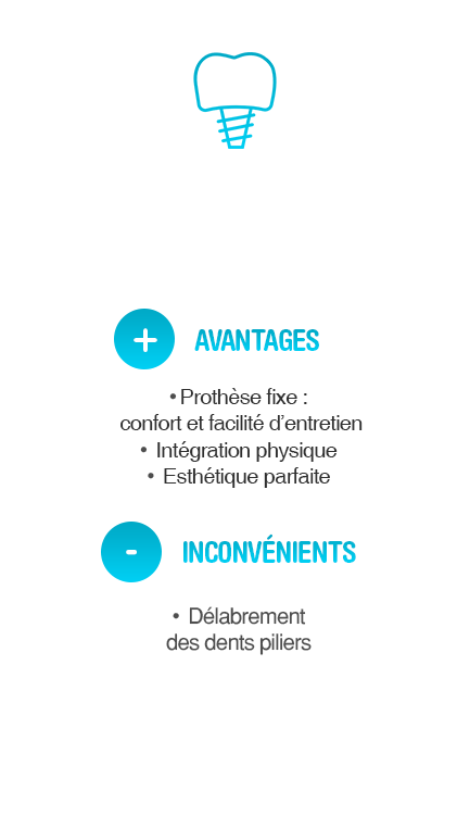 les centres dentaires mutualistes bridge