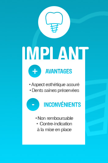 les centres dentaires mutualistes implant