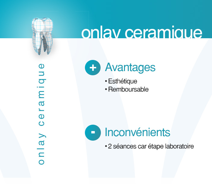 les centres dentaires mutualistes onlay ceramique